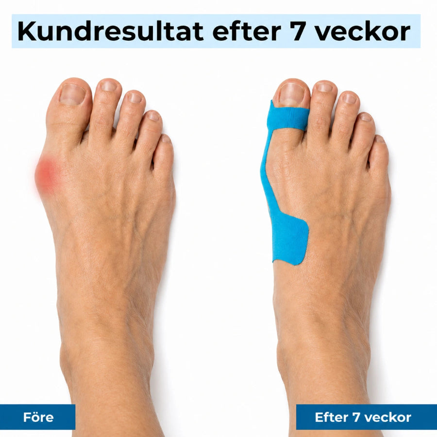 ActiveTape™ - För en rakare stortå och avlastad knöl