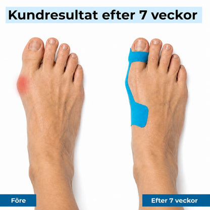 ActiveTape™ - För en rakare stortå och avlastad knöl